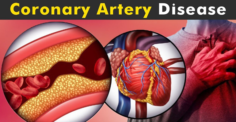 Coronary Artery Disease treatment and diagnosis